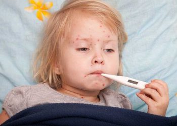 Dịch sởi bùng phát: Cách phòng và điều trị bệnh từ chuyên gia